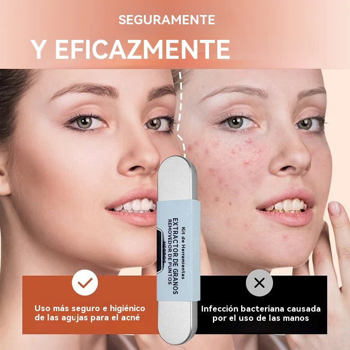 😘 💓【16 piezas】Juego de herramientas de grado médico para eliminar puntos negros