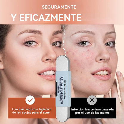 😘 💓【16 piezas】Juego de herramientas de grado médico para eliminar puntos negros