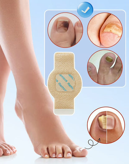 💥【42 piezas】Pegatinas antimicóticas para uñas