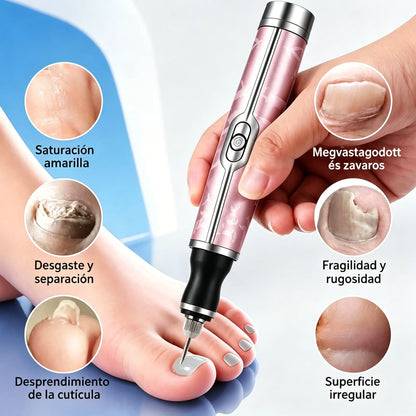💅👍 Lima eléctrica para uñas para el tratamiento de la onicomicosis