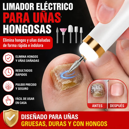 🦶🦶 Lima eléctrica para uñas de los pies para hongos en las uñas, una lima eléctrica pequeña.