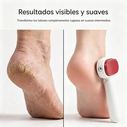 🔥2 juegos por 26 euros📢📢¡50% de descuento! ⏰Exfoliante de pies de doble cara, elimina fácilmente los callos.