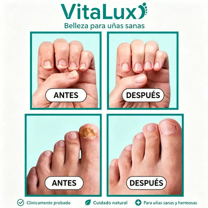 🦶Dispositivo para el cuidado de las uñas