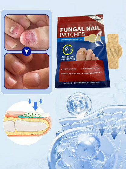 💥【42 piezas】Pegatinas antimicóticas para uñas